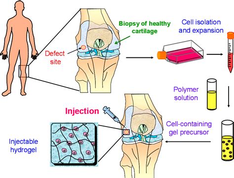  Dextran: A Biocompatible Wonder Material for Injectable Drug Delivery and Tissue Engineering!